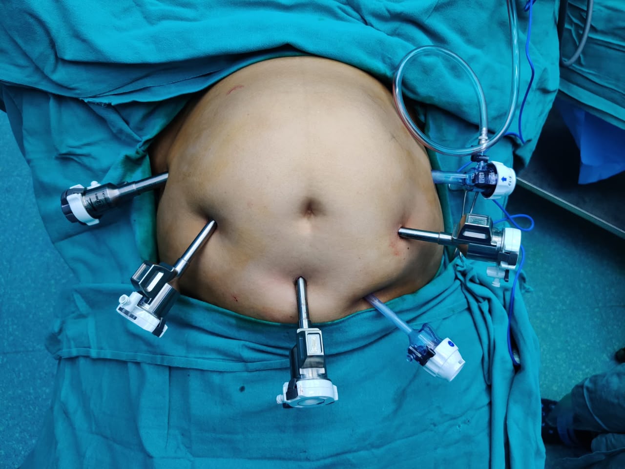 Robotic surgery ports